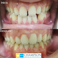 Champion Dental & Ortodoncia