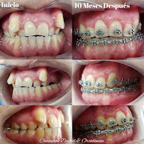 Champion Dental & Ortodoncia