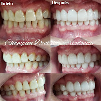 Champion Dental & Ortodoncia