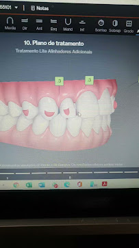 Dra. Viviane Amaral Dentista Invisalign em Brasilia - Alinhador Invisível Asa Sul
