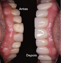 OdontoVita