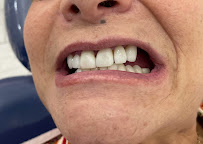 Dentista general coronas e implantes dentales