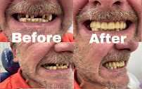 Dentista general coronas e implantes dentales