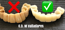 Dentista general coronas e implantes dentales