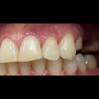 Dentista general coronas e implantes dentales