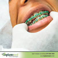Implantomed Dental Implants in Brasilia