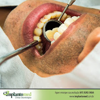 Implantomed Dental Implants in Brasilia