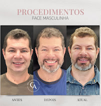 Clínica Ávila - Harmonização Facial - Odontologia - Prótese Dentária - Asa Sul - Brasília - DF