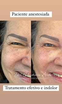 Clínica Ávila - Harmonização Facial - Odontologia - Prótese Dentária - Asa Sul - Brasília - DF
