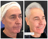 Clínica Ávila - Harmonização Facial - Odontologia - Prótese Dentária - Asa Sul - Brasília - DF