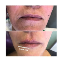Clínica Ávila - Harmonização Facial - Odontologia - Prótese Dentária - Asa Sul - Brasília - DF