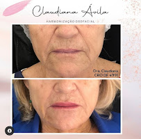 Clínica Ávila - Harmonização Facial - Odontologia - Prótese Dentária - Asa Sul - Brasília - DF