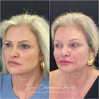 Clínica Ávila - Harmonização Facial - Odontologia - Prótese Dentária - Asa Sul - Brasília - DF