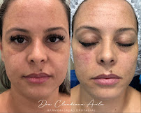 Clínica Ávila - Harmonização Facial - Odontologia - Prótese Dentária - Asa Sul - Brasília - DF