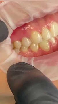 OdontoMaxx