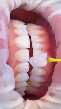 OdontoMaxx
