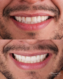 Dr. Miguel Robles - Odontología Estética