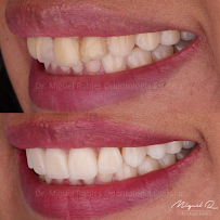 Dr. Miguel Robles - Odontología Estética