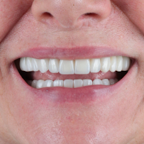 CROI Odontologia - Referência em Implantes Dentários e Próteses Dentárias