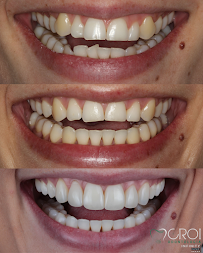 CROI Odontologia - Referência em Implantes Dentários e Próteses Dentárias
