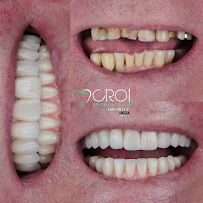 CROI Odontologia - Referência em Implantes Dentários e Próteses Dentárias