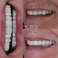 CROI Odontologia - Referência em Implantes Dentários e Próteses Dentárias