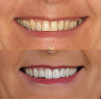 Moreti Odontologia