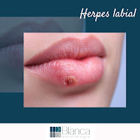 Blanca Odontologia