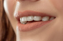 Dra. Talita Chimeli 🏅- Faceta de Porcelana - Lente de contato - Odontologia Estética e Funcional