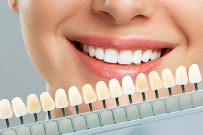 Dra. Talita Chimeli 🏅- Faceta de Porcelana - Lente de contato - Odontologia Estética e Funcional