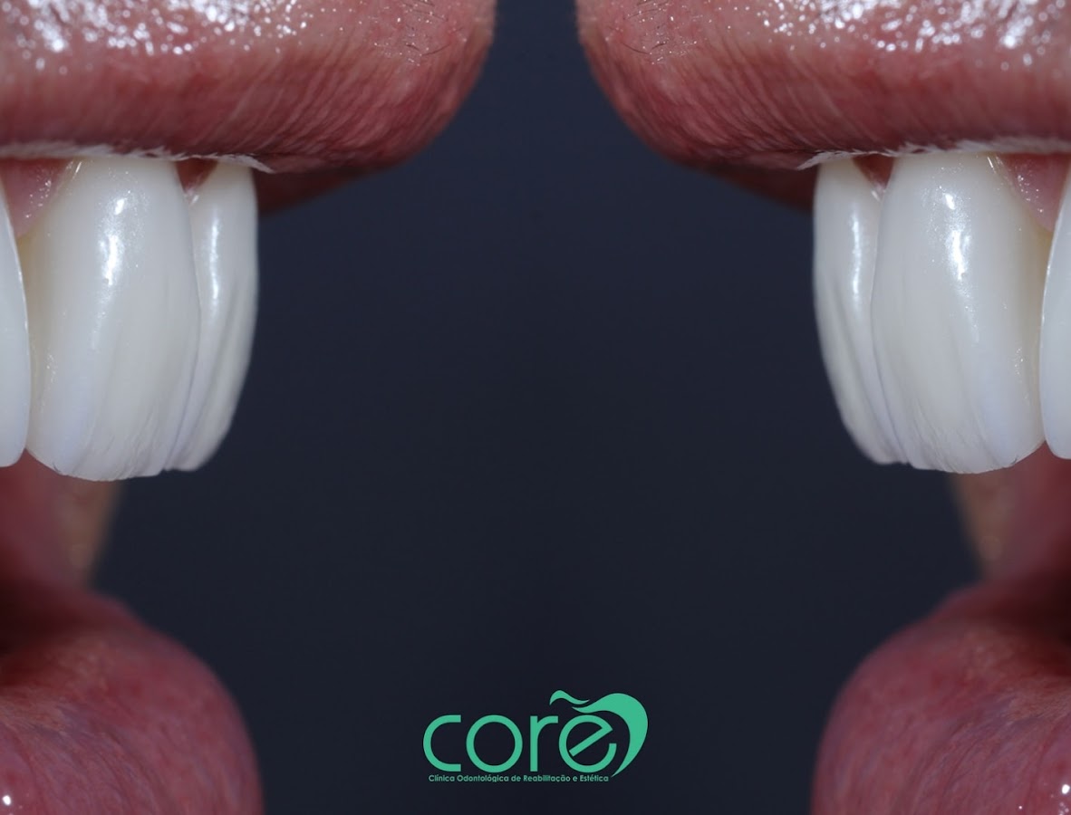 CORE - Clínica Odontológica de Reabilitação e Estética - dental clinic in Brasília