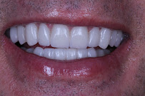 CORE - Clínica Odontológica de Reabilitação e Estética