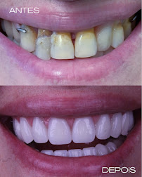 Royal Implantes