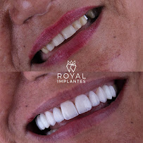 Royal Implantes