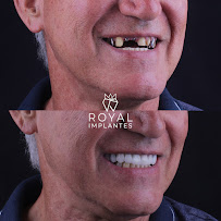 Royal Implantes