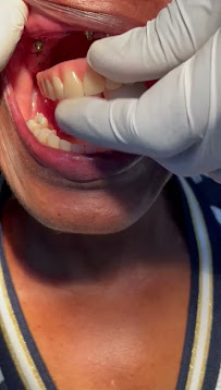Dentista Baiano - Especialista em Implantes Dentários em Salvador