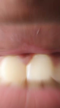 Dentista Baiano - Especialista em Implantes Dentários em Salvador