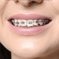 Clínica Odontológica na Barra I Medrado Odontologia I Implante Dentário e outros I Dentista em Salvador, Ba