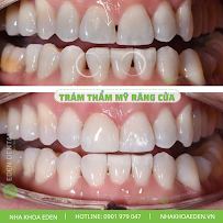 Nha Khoa Eden Quận 1 - Eden Dental Clinic D1 - Nha Khoa Uy Tín Quận 1