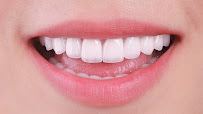Nha Khoa Eden Quận 1 - Eden Dental Clinic D1 - Nha Khoa Uy Tín Quận 1