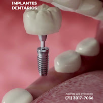 Dentista Tatiana Mendes Ortodontista, Implantes Dentários I Aparelho transparente I Aparelho ortodôntico I Salvador