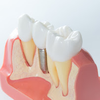 Dentista Tatiana Mendes Ortodontista, Implantes Dentários I Aparelho transparente I Aparelho ortodôntico I Salvador
