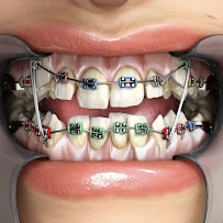 Dentista Tatiana Mendes Ortodontista, Implantes Dentários I Aparelho transparente I Aparelho ortodôntico I Salvador