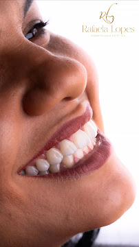Dentista Rafaela Lopes - Lente de Contato Dental em Salvador - Lentes de Resina Valor facetas