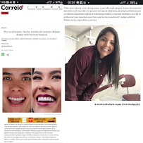 Dentista Rafaela Lopes - Lente de Contato Dental em Salvador - Lentes de Resina Valor facetas
