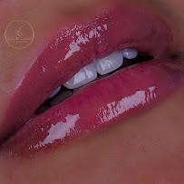 Dentista Rafaela Lopes - Lente de Contato Dental em Salvador - Lentes de Resina Valor facetas
