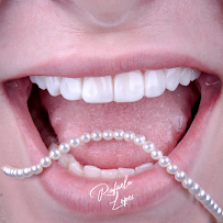Dentista Rafaela Lopes - Lente de Contato Dental em Salvador - Lentes de Resina Valor facetas