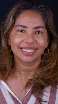 Dentista Rafaela Lopes - Lente de Contato Dental em Salvador - Lentes de Resina Valor facetas