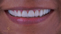 Dentista Rafaela Lopes - Lente de Contato Dental em Salvador - Lentes de Resina Valor facetas