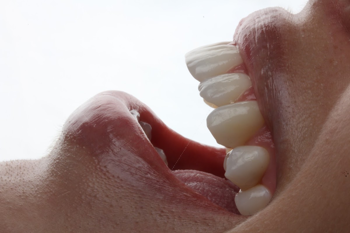 Precision Dental Studio - Dentista Salvador - BA - dental clinic in Salvador, Brazil